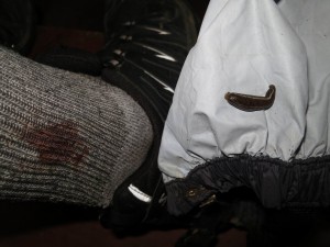 Leech Bite even under the Gaiters Leech Bite even under the Gaiters