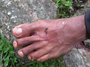 Bare Feet - the local Leech Protection Bare Feet - the local Leech Protection